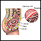 Muestra de vellosidad coriónica - anatomía normal