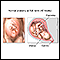 Nacimiento vaginal - Serie - anatomía normal