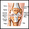 Ligamento cruzado anterior reparación - serie