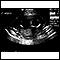 Ultrasonido de un feto normal - ventrículos cerebrales