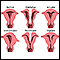 Anomalías uterinas congénitas