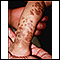 Incontinencia pigmentada en la pierna