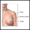 Extirpación del tumor de seno - serie - Anatomía normal