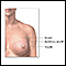 Anatomía del seno femenino normal
