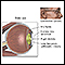 <div class=media-desc><strong>Aged eye anatomy</strong><p>With age, the lens may become misshaped and the corneal tissue may become clouded.</p></div>