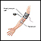 Duplex/doppler ultrasound test