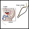 <div class=media-desc><strong>Bladder biopsy</strong><p>A bladder biopsy is performed if abnormalities of the bladder are found, or if a tumor is grossly visible. During the biopsy a small portion of tissue is removed and sent to the laboratory for analysis.</p></div>