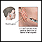 Biopsia de glándula salival