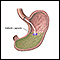 Cápsula de gelatina en el estómago